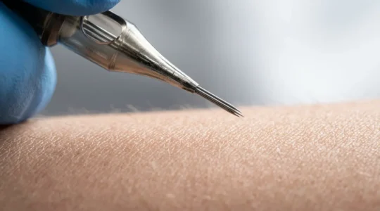 Gros plan artistique sur une aiguille de micro-tatouage effleurant délicatement la peau, capturant la précision et la finesse de cette pratique