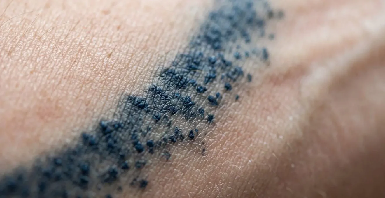 Vue macro d'un tatouage montrant la dispersion des pigments sous une peau étirée