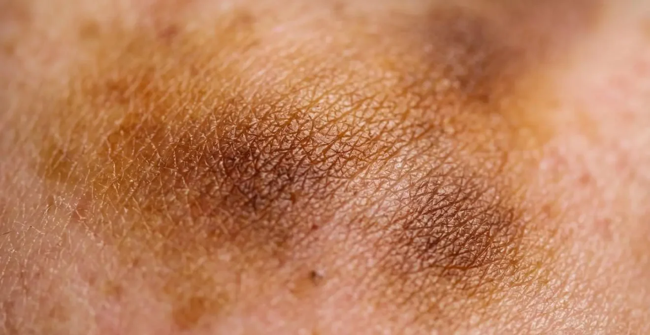 Palette de pigments pour taches de rousseur vue en macro montrant les différentes nuances
